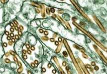 Вирус птичьего гриппа (желтые включения). Фото предоставлено АР Американским Центром контроля над заболеваниями