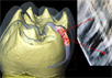 CT-сканирование неандерталького зуба с высоким разрешением. Изображение с сайта sciencenow.sciencemag.org