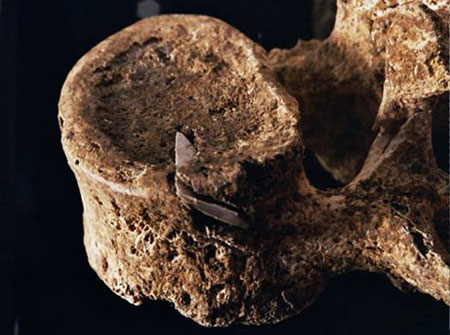 Человеческий позвонок из британской могилы каменного века с застрявшим в нем наконечником стрелы (указывающим на насильственную смерть). Фото EH/NMR с сайта National Geographic